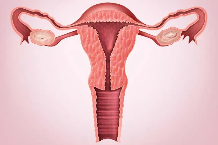 Hysterectomy (Uterus Removal)