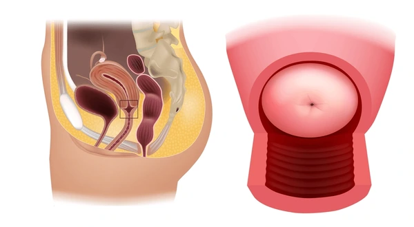 Cervix (Mouth of the Uterus)